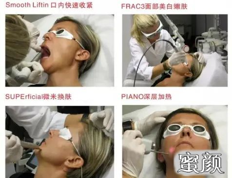 https://img.yiyiaimei.com/mnt/timg/201223/144424MD-5.jpg