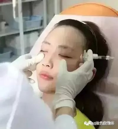 案例图片