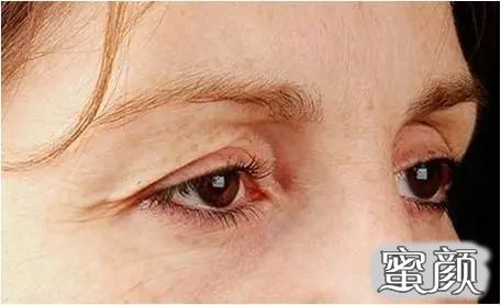 案例图片