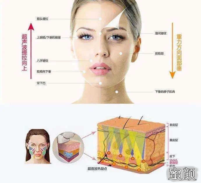 https://img.yiyiaimei.com/mnt/timg/201225/1940444109-1.jpg