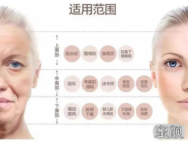 https://img.yiyiaimei.com/mnt/timg/201225/1940456093-4.jpg