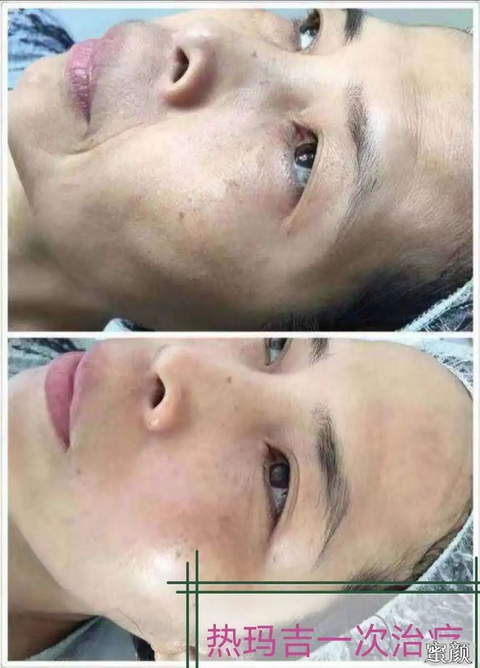 案例图片