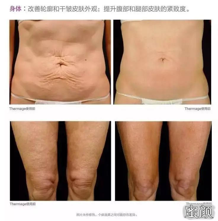 案例图片