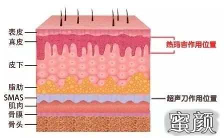 案例图片
