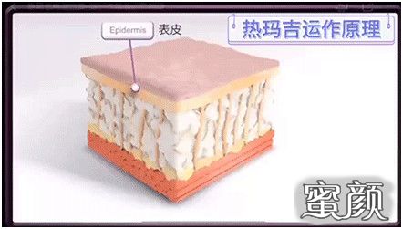 案例图片