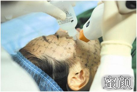 案例图片