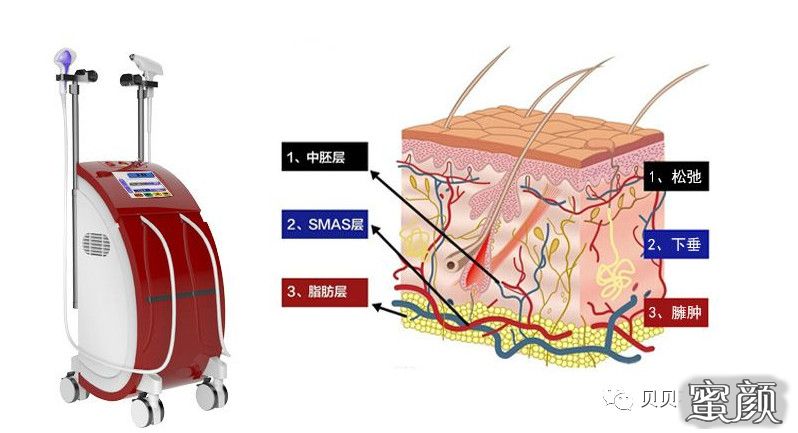 案例图片