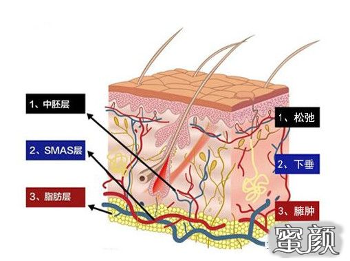 案例图片