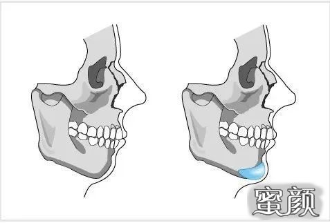 案例图片