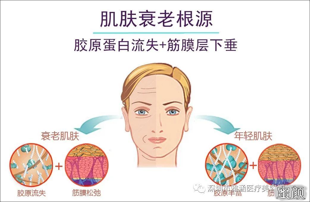 案例图片