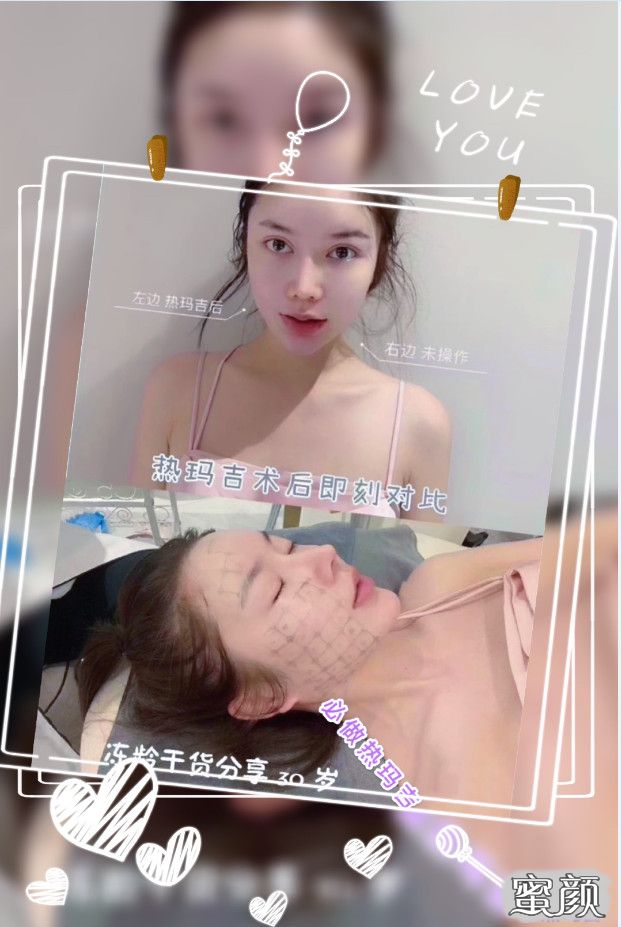 案例图片