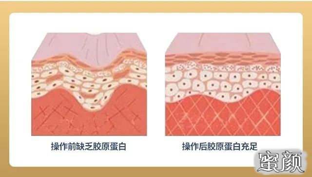 https://img.yiyiaimei.com/mnt/timg/201226/1942324163-3.jpg
