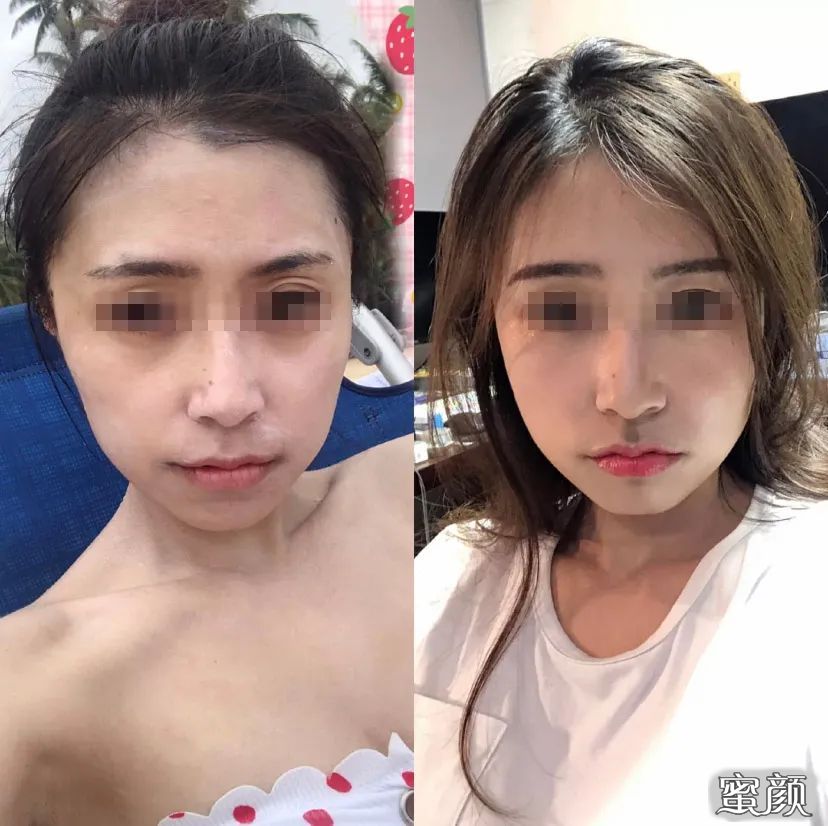 案例图片
