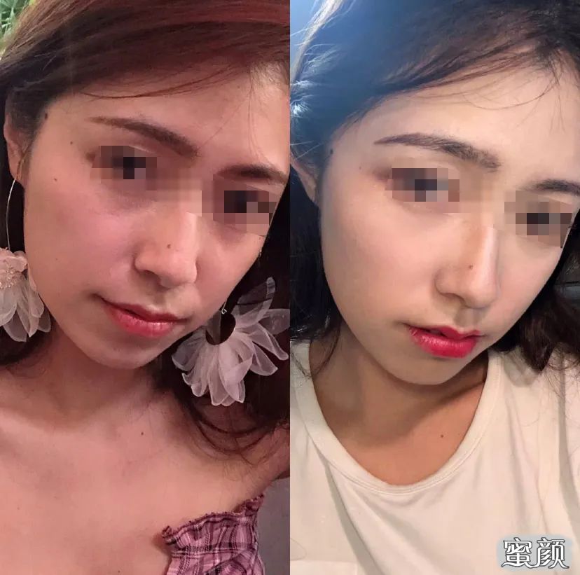 案例图片