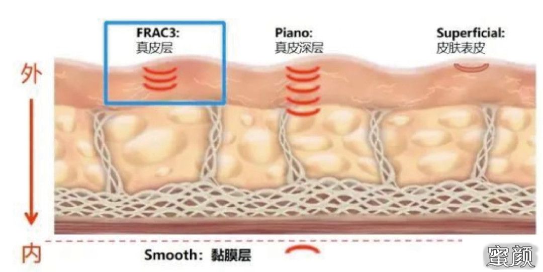 案例图片