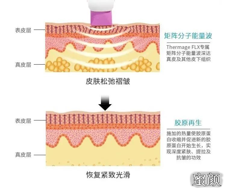 案例图片