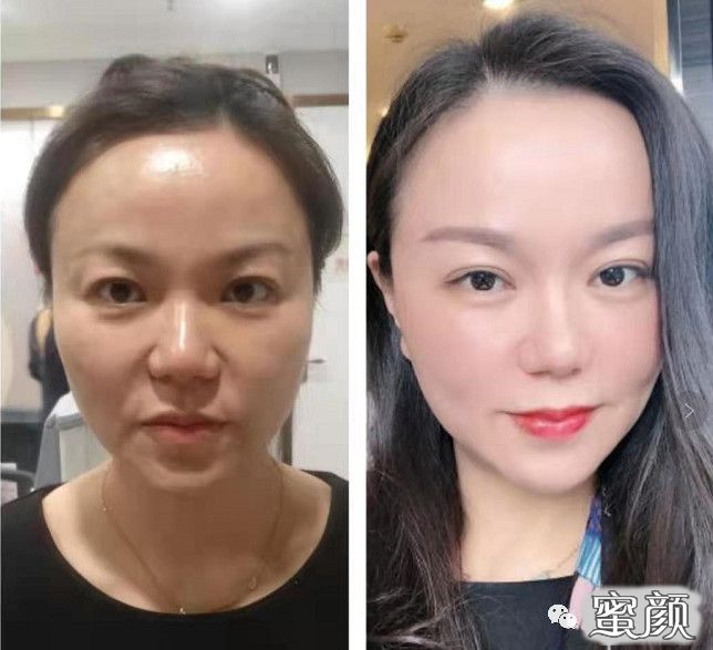 案例图片