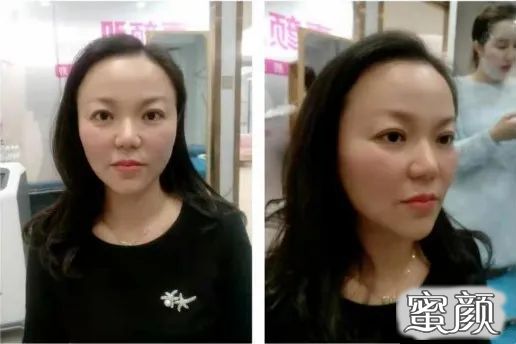 案例图片