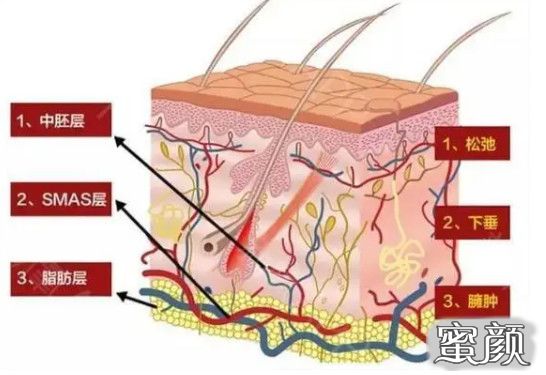 案例图片