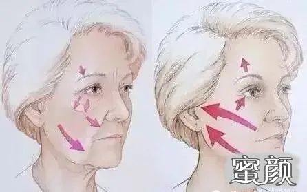 案例图片