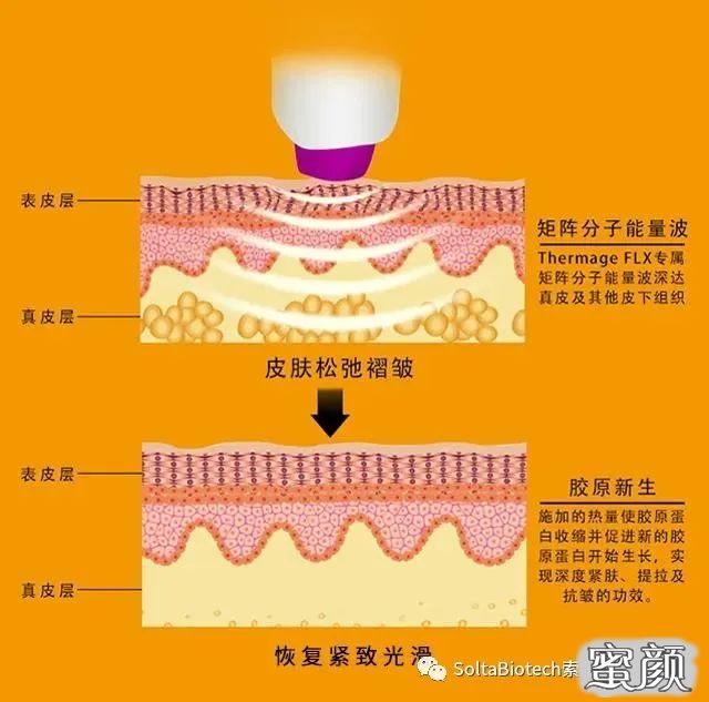 案例图片