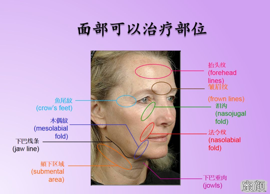 案例图片