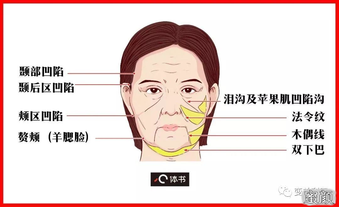 案例图片
