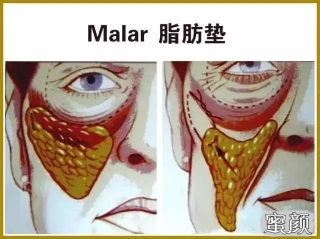 案例图片
