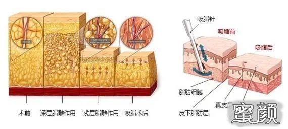 案例图片