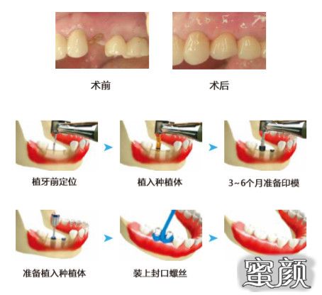 案例图片