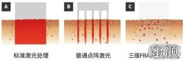 案例图片