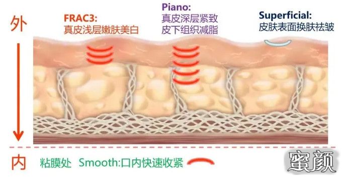 案例图片