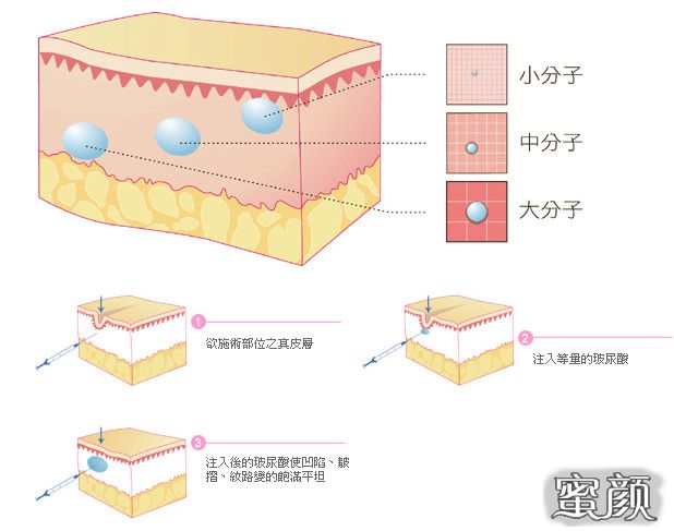 案例图片