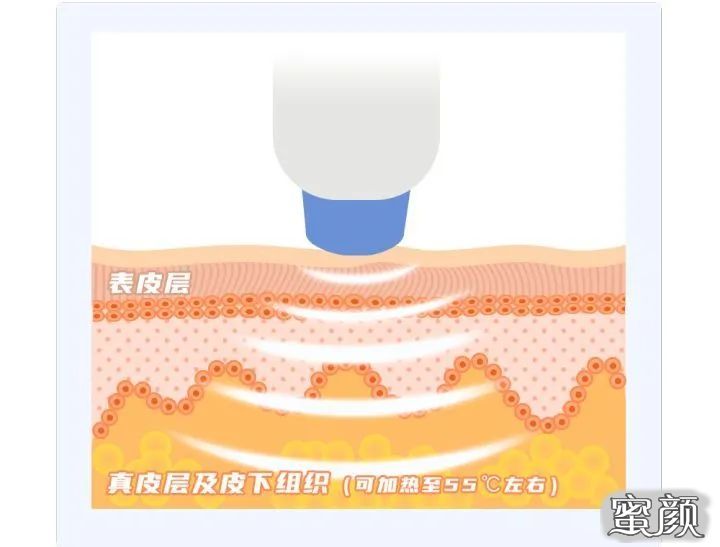 案例图片