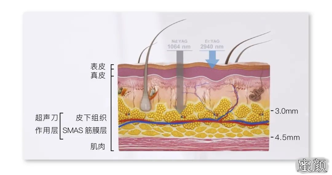 案例图片