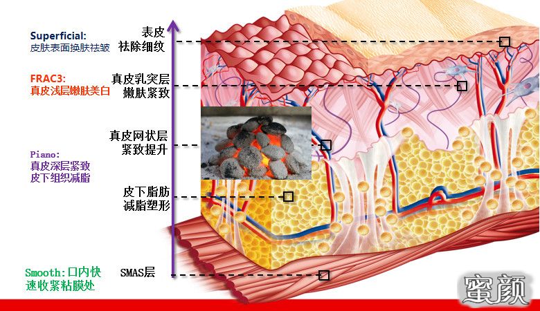 案例图片