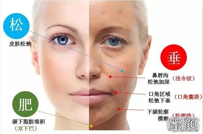 案例图片