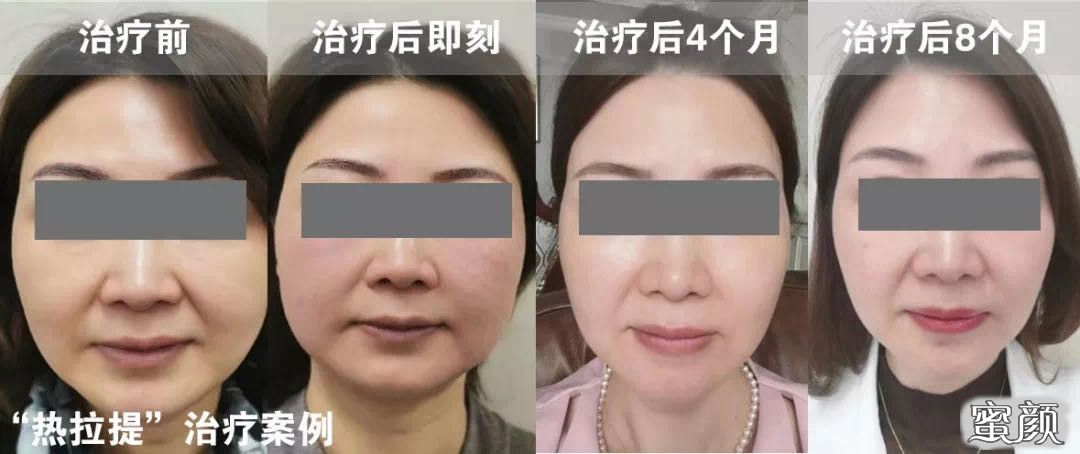 案例图片