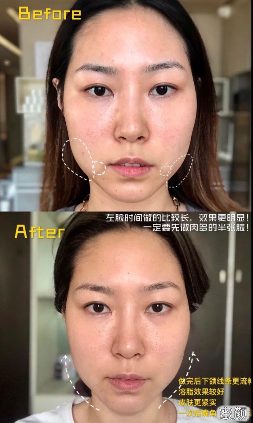 案例图片