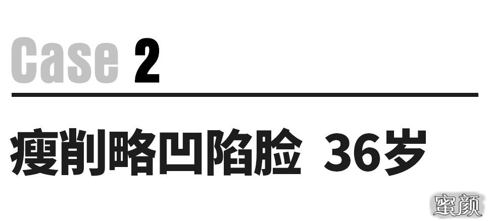 案例图片