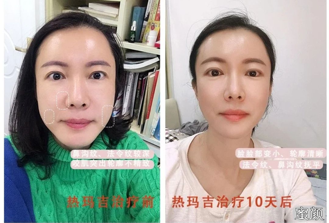 案例图片