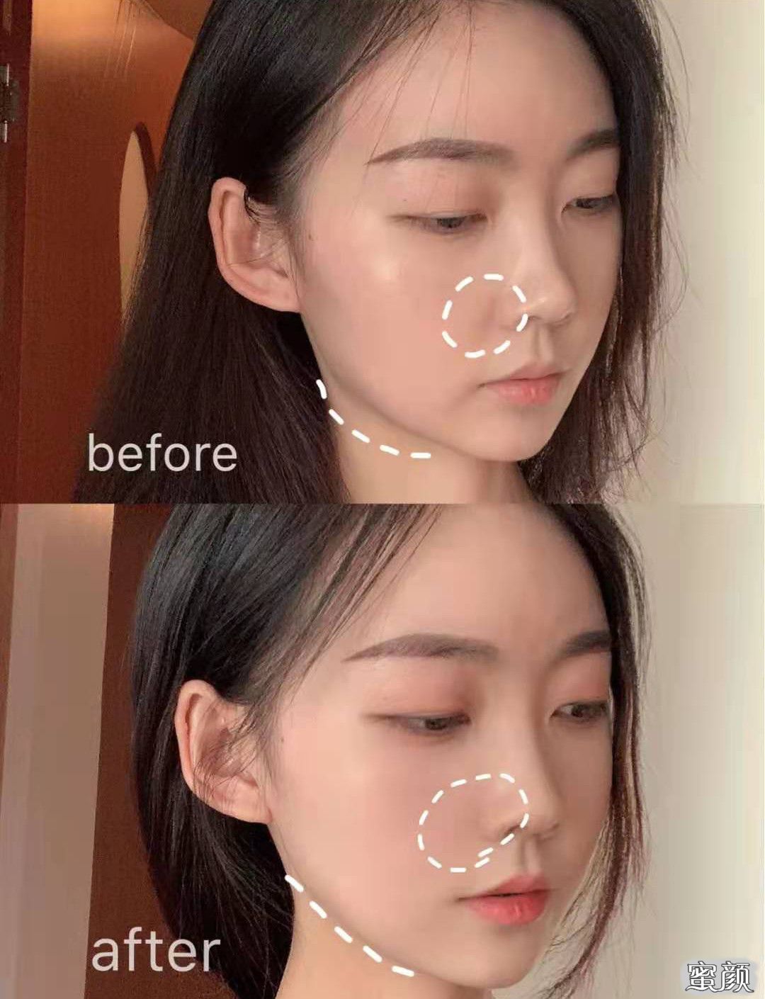 案例图片
