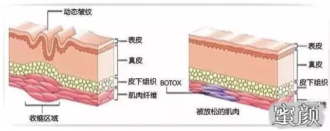 案例图片