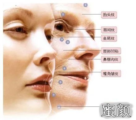 https://img.yiyiaimei.com/mnt/timg/201230/140T935Z-2.jpg