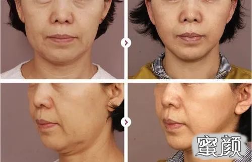 https://img.yiyiaimei.com/mnt/timg/201230/140UK391-5.jpg