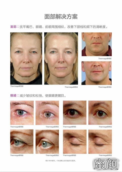 https://img.yiyiaimei.com/mnt/timg/201230/144K26327-9.jpg