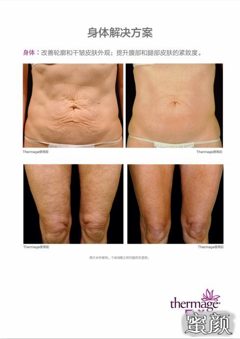 https://img.yiyiaimei.com/mnt/timg/201230/144K33435-10.jpg