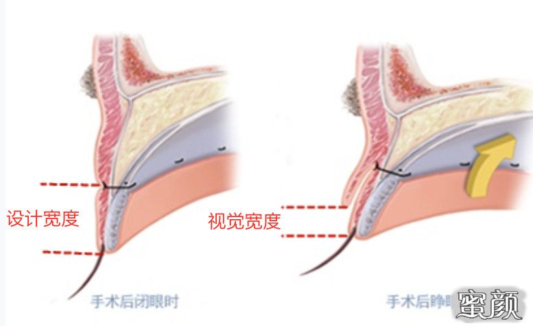 案例图片