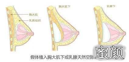 案例图片