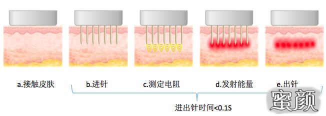 案例图片